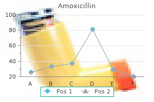 purchase 250 mg amoxicillin