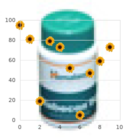 Renal caliceal diverticuli deafness