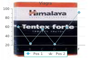 discount viagra 50mg amex