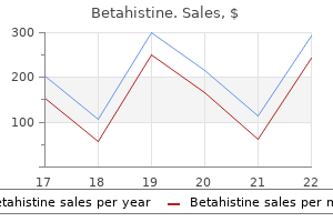 buy discount betahistine on line