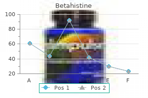 cheap betahistine 16mg fast delivery