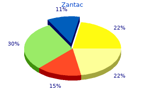 buy generic zantac on line